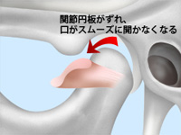 異常なし